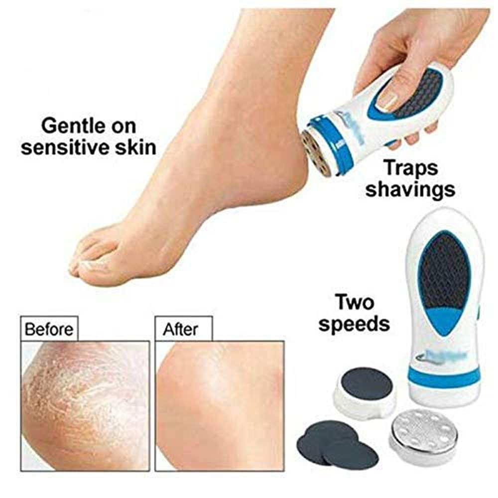 Foot Care Callus Remover for Smoothness