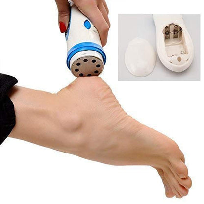 Foot Care Callus Remover for Smoothness